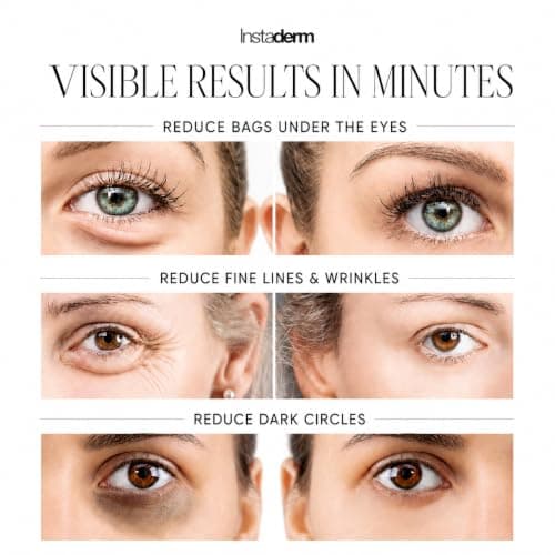 Instant Eye Tightener – Instantly Reduces Under Eye Bags, Puffiness, Dark Circles, Wrinkles & Crow's Feet. Naturally Ageless Hydrating Cream. Disappears Before Your Eyes Within Minutes.
